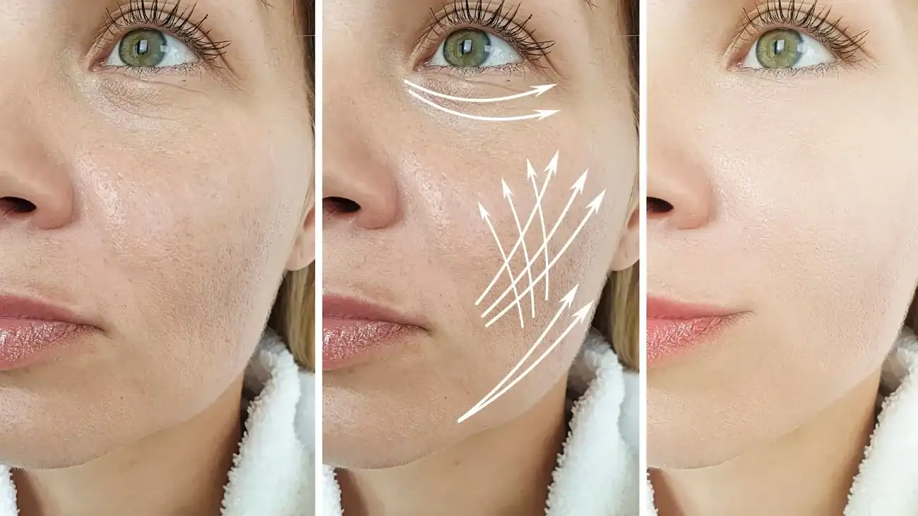 Can One Treatment Really Tackle More Than One Skin Concern Burnley?