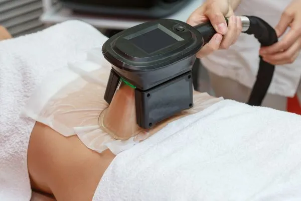 Image of person having fat freezing treatment to help weight gain Burnley