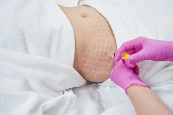 image of fat dissolving injections on love handles to help combat weight gain Burnley