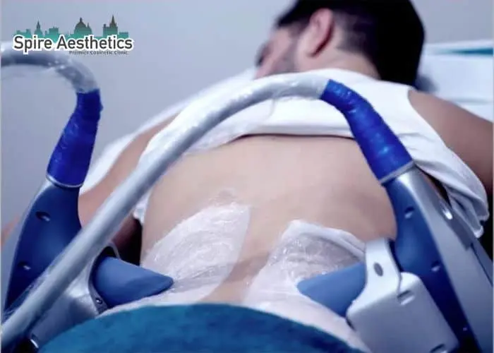 Man having fat freezing treatment done on love handles before a competitions Burnley to create a sculpted look.