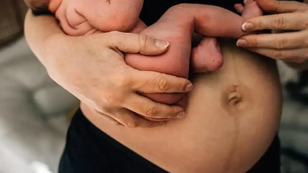 Why Is My Stomach Still Big After Pregnancy Burnley?
